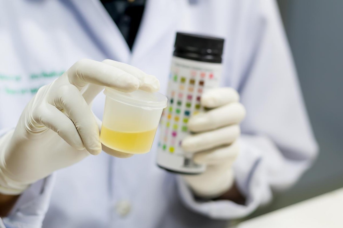 多喝水就能降尿酸？医生：最有效的不是喝水，建议做好这3个点！(图3)