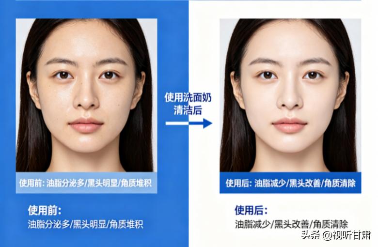 男士洁面乳哪个品牌好用？真实测评高口碑洁面！控油温和不拔干(图4)