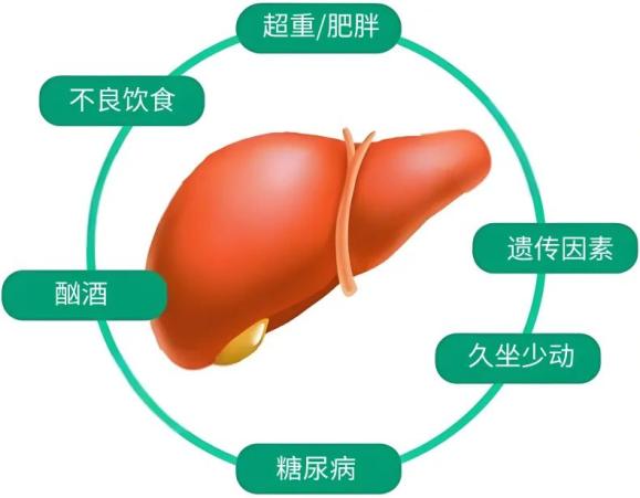 体重没超标，肝脏咋先告急了？(图5)
