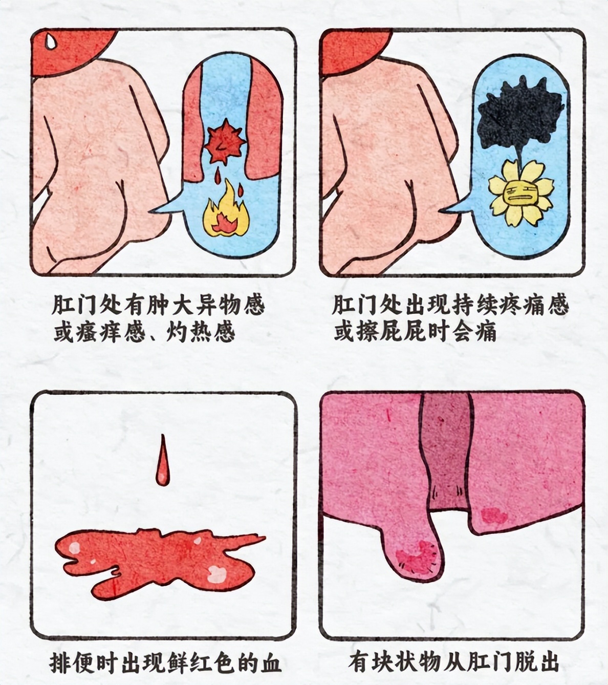哺乳期痔疮发作怎么办？一位妈妈的灵魂三问，医生这样答(图3)