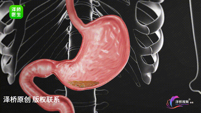 7个睡眠坏习惯,小心变胖又变丑(图2)