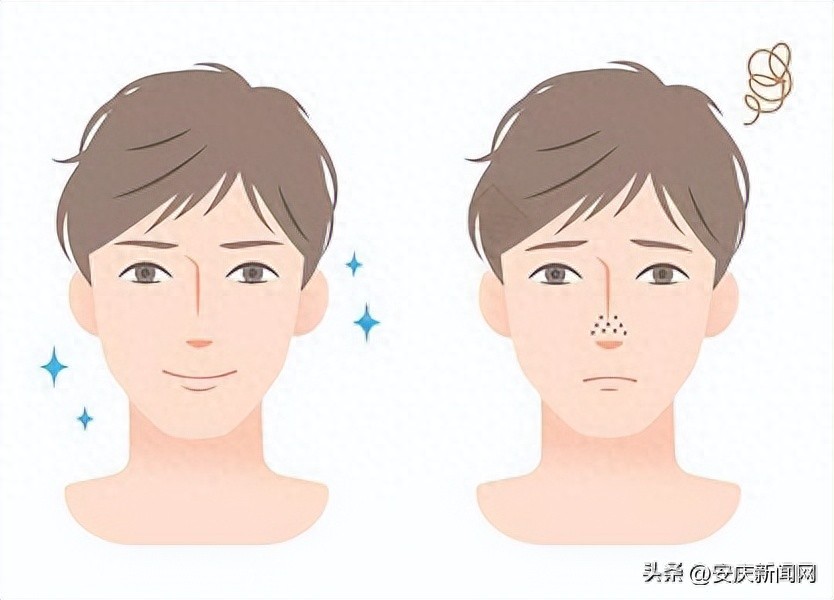 男士收缩毛孔十大排行榜｜2026控油收毛孔精华测评，减少痘痘