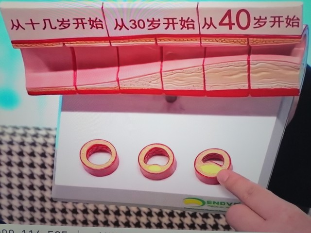冠心病不好的人注意！牢记“两不吃两不喝”，管住嘴就是保健康(图9)