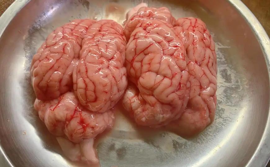 我国越来越多的人患脑梗？建议：停止食用6物，保护大脑(图6)
