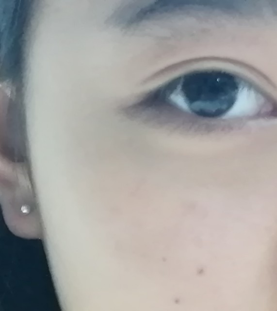 荔枝美小程序：告别“熊猫眼”，这些去黑眼圈妙招你知道吗？(图3)