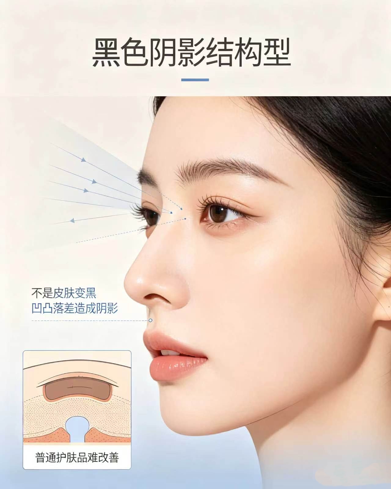早睡也消不掉黑眼圈？原来一直都搞错了！(图5)