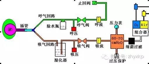 呼吸机---不再是冰冷的机器(图2)