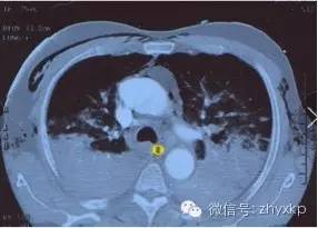 呼吸机---不再是冰冷的机器(图3)