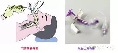 呼吸机---不再是冰冷的机器(图5)