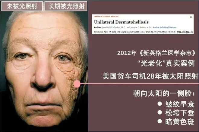 过度防晒,正在掏空女性的骨头(图17)