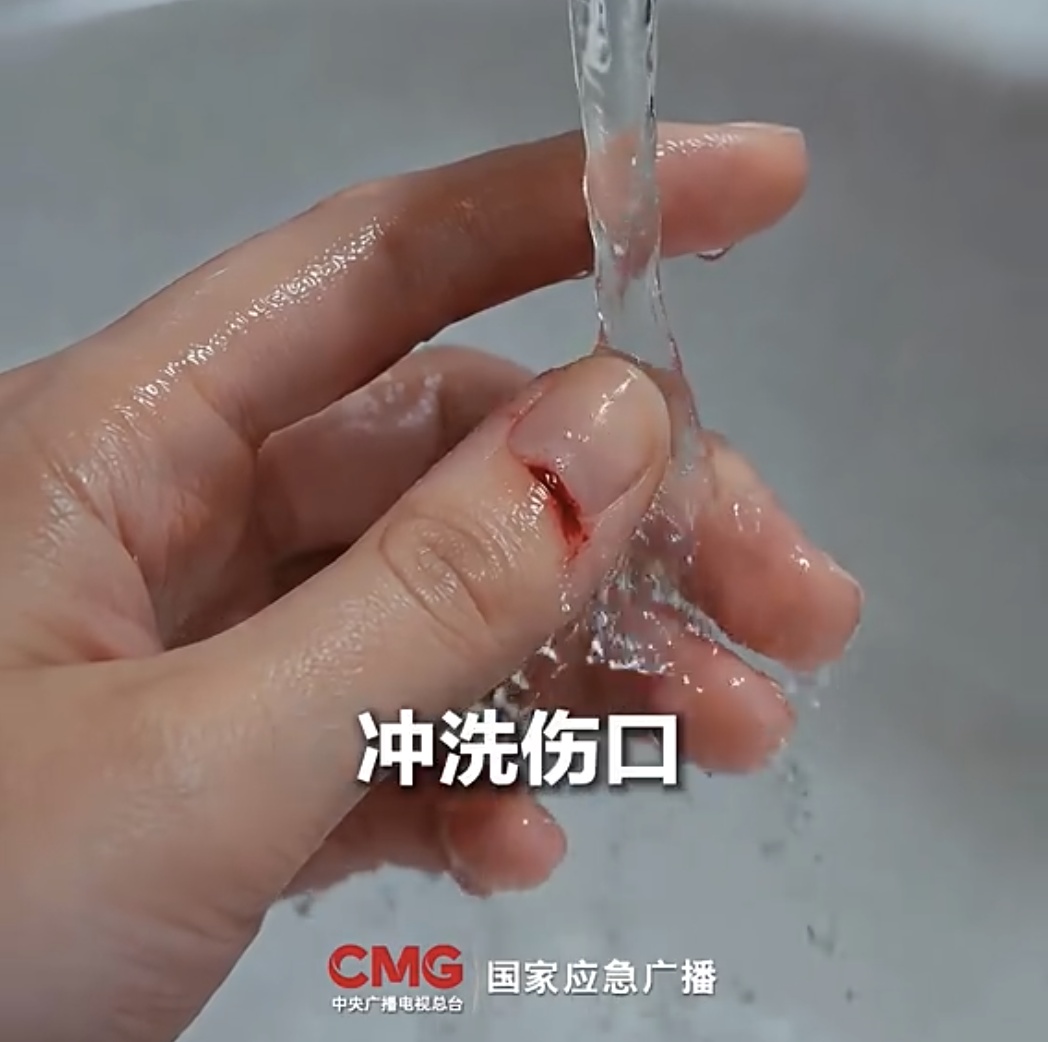 上山砍毛竹突然被“刺”，处置不当可能诱发致命感染！医生提醒→(图2)