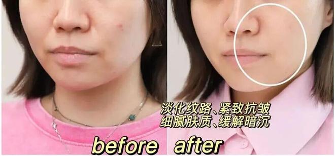 真爱返场|| 陪了我10年的好物，一年就等这么一回捡大漏(图36)